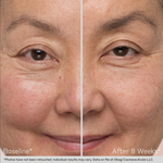 Obagi Eyebrow Boosting Serum