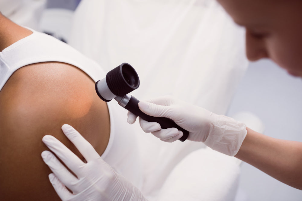 Dermatologist performing a full body skin check during a skin cancer screening exam in San Francisco.