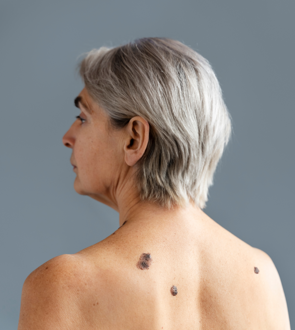 Caren Campbell, Md